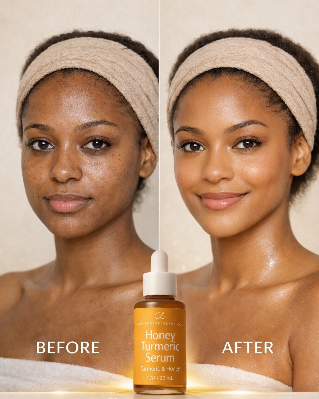 Honey Turmeric  Serum - conveyorskincare.com